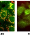 Billederne viser kræftceller, som i seks timer har været udsat for BE-43547 og har fået tilført et grønt-fluorescerende reagens, der akkumulerer og ændrer farve til rød/gul i mitokondrier med intakt membranspænding. Forskellen på de to billeder er, at cel