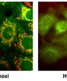 Billederne viser kræftceller, som i seks timer har været udsat for BE-43547 og har fået tilført et grønt-fluorescerende reagens, der akkumulerer og ændrer farve til rød/gul i mitokondrier med intakt membranspænding. Forskellen på de to billeder er, at cel