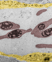 Pseudofarvet elektronmikrograf, der viser nanopartikler, der cirkulerer i blodbanen sammen med røde blodlegemer (rødbrune), og de der er opfanget i endotelceller, der ligger i blodkaret (gule) (Figur: Yuya Hayashi).